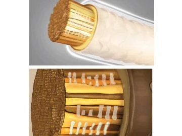 MOOD Link-D-Technologie